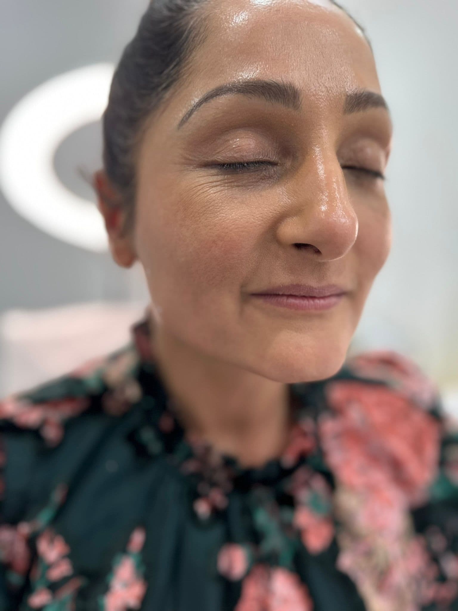 Skin Boosters & Injectables treatments in Birmingham